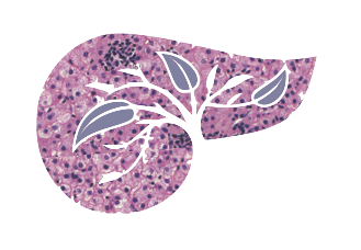 biopsia